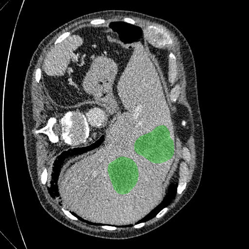 Lesion expert reference