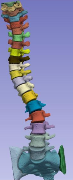 Labeled 3D spine